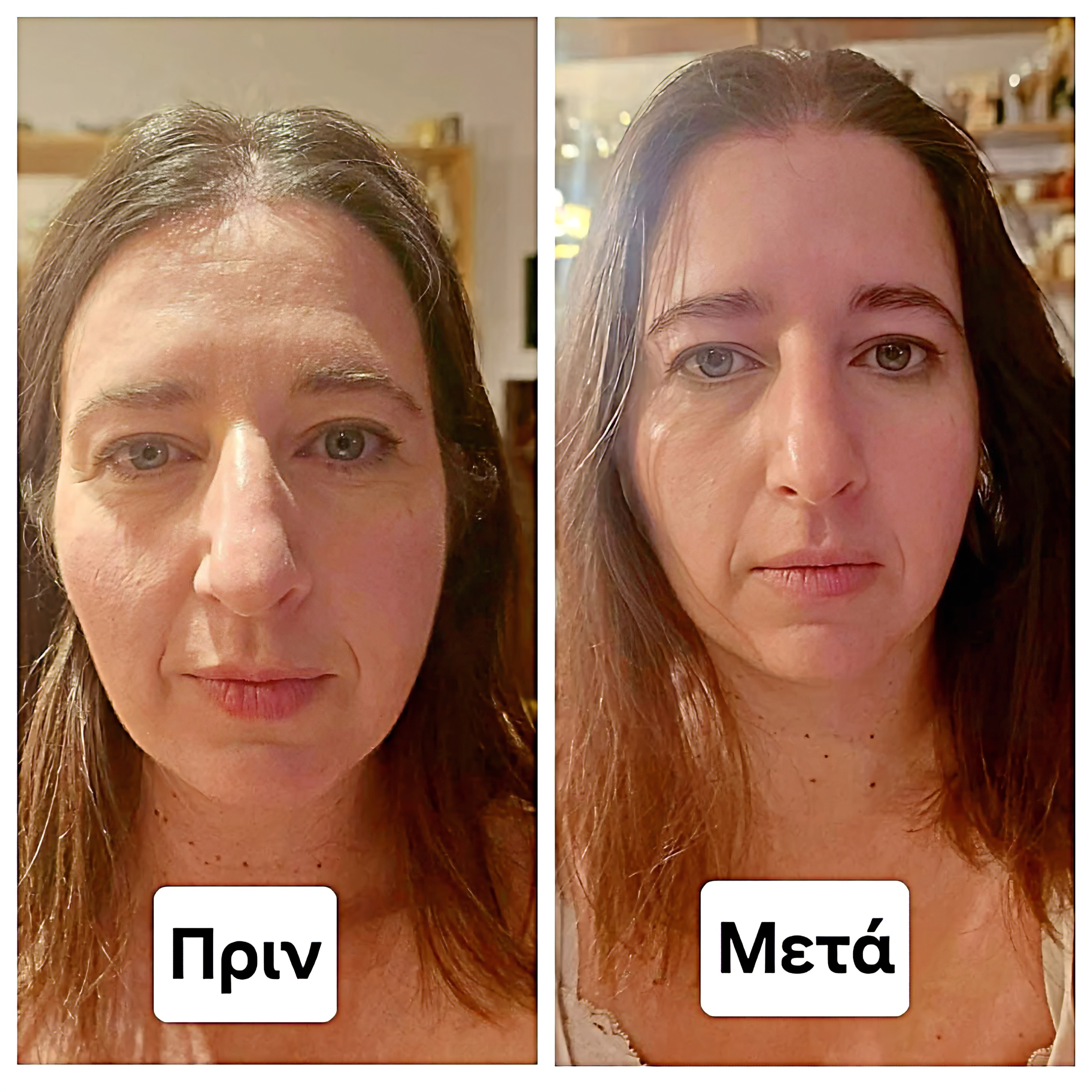 Massage treatment: Rejuvance – The Natural Bioenergetic Facelift
